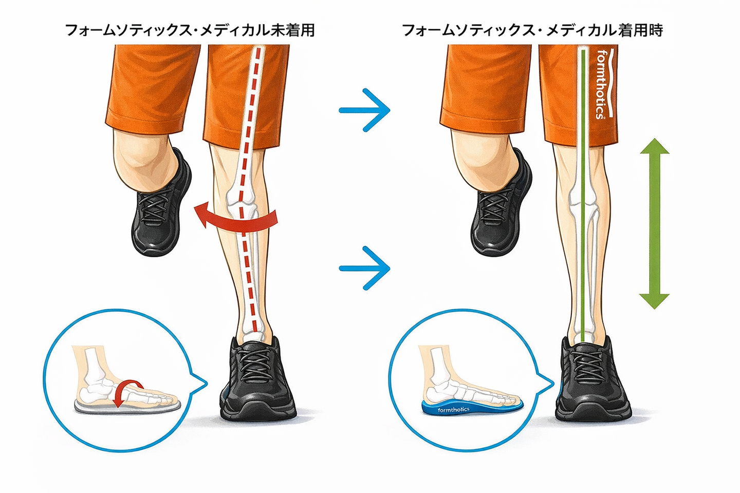 フォームソティックス